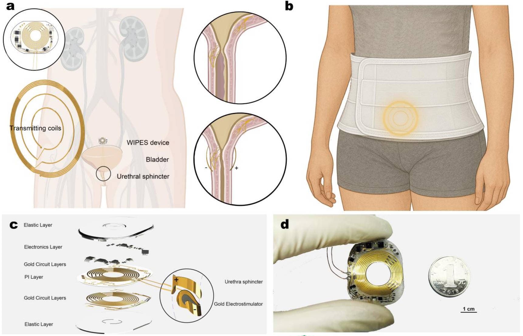 WIPES device overview